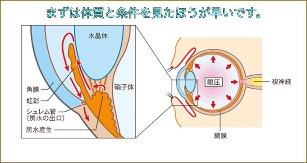緑内障のリスク